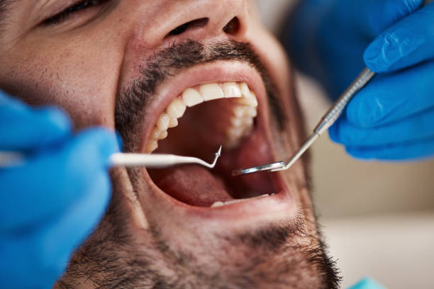 Best Pediatric Emergency Dentist in Biltmore, TN